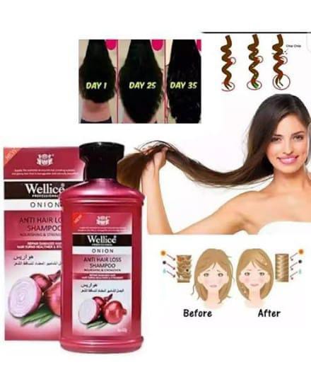 Premium Wellice Anti Hair Loss Oil